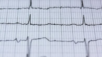 neural pulse hyper beam